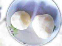 家常菜炝土豆丝做法图解1)