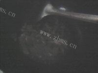 腊肉炒青椒做法图解2)