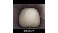 色香味浓的挤挤小面包做法图解2)