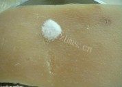 广式脆皮烧肉做法图解5)